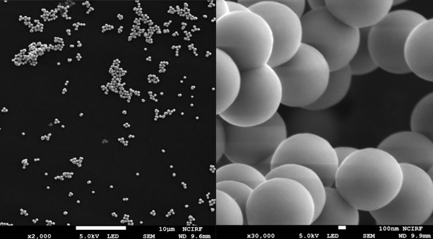 코어 직경 조절